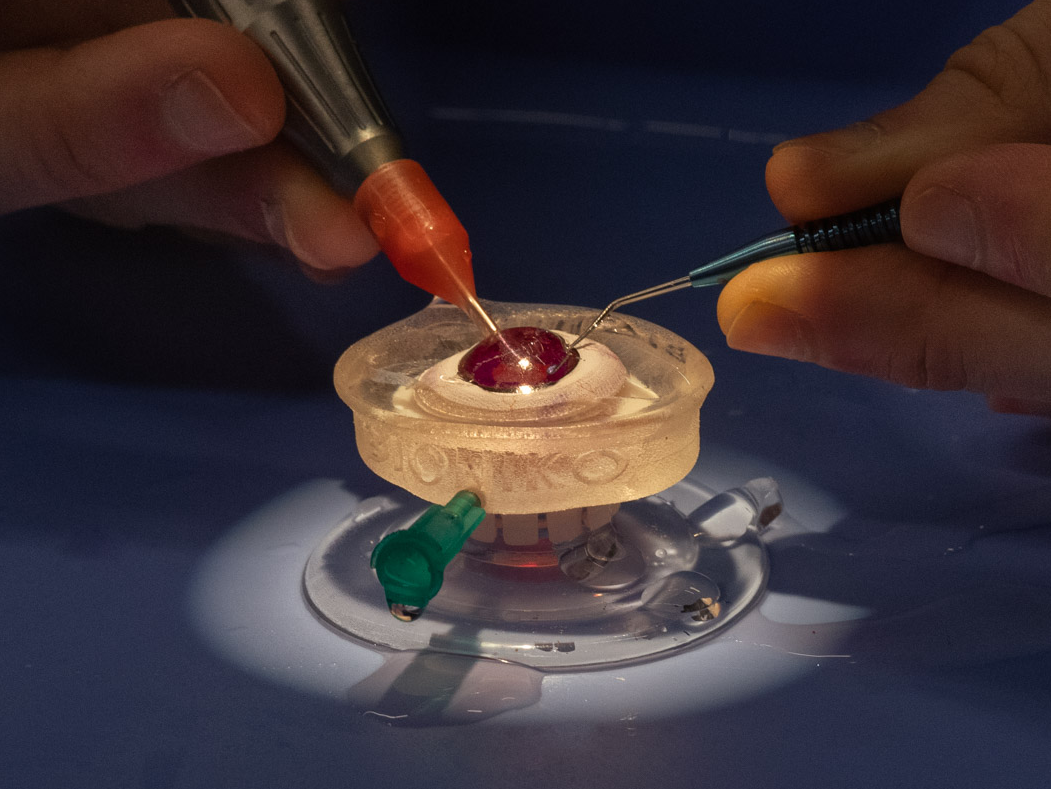 Phaco Machine & Instruments Wills Eye Library